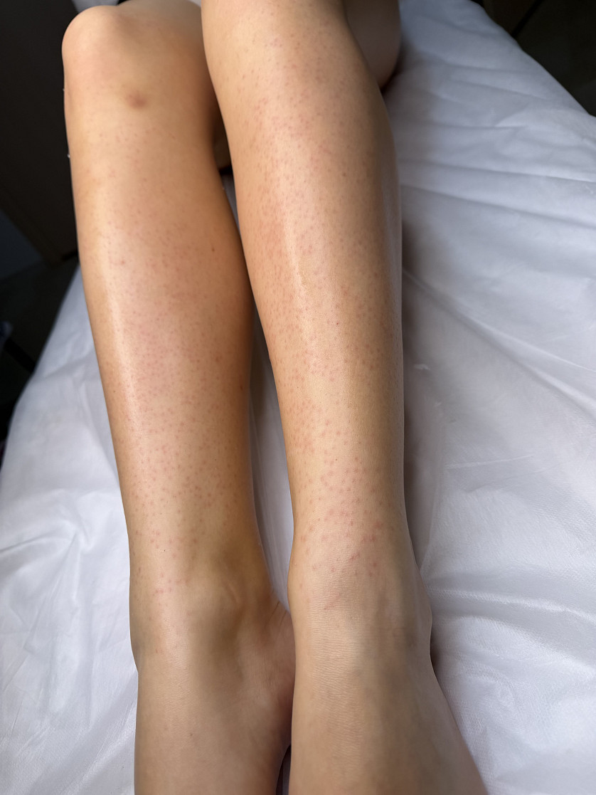 Epilare изображение 1