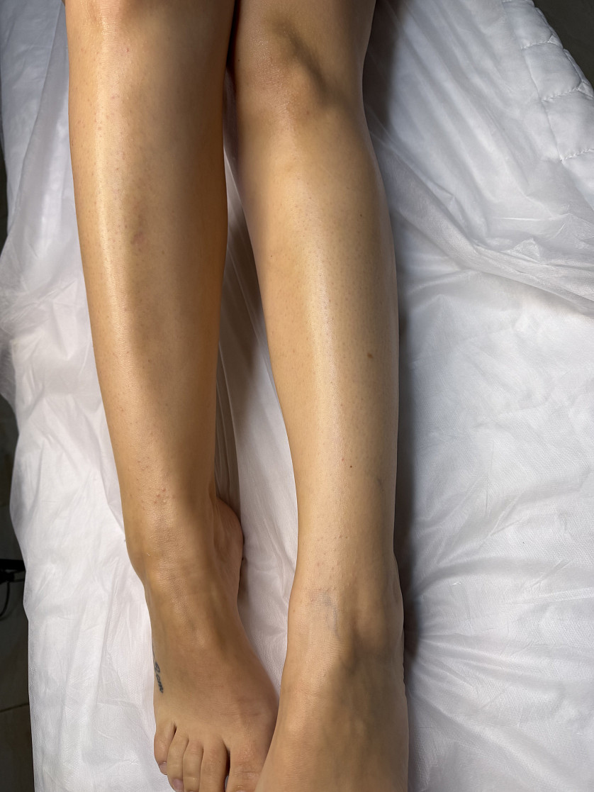 Epilare изображение 2